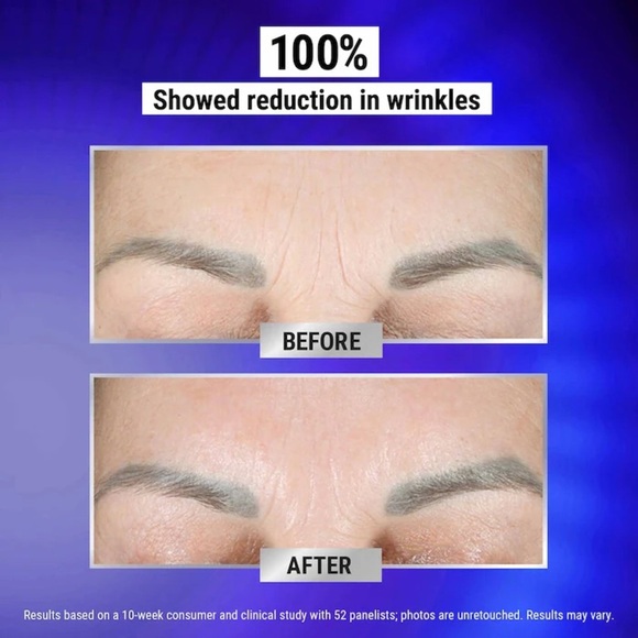 🆕 KIEHL’S Retinol Fast Release Wrinkle-Reducing Night Serum NIB / Sealed - Picture 8 of 9